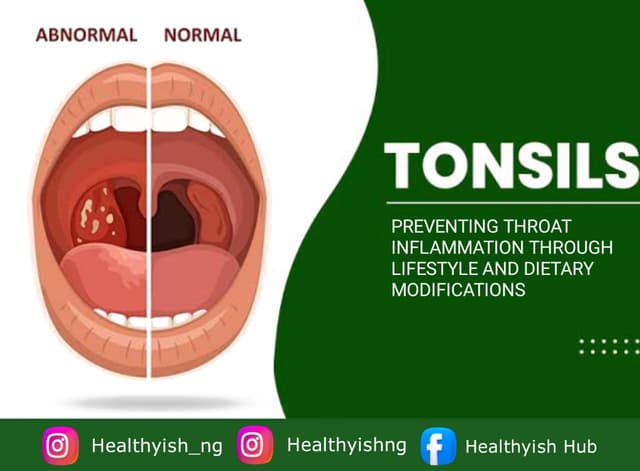 PREVENTING THROAT INFLAMMATION THROUGH LIFESTYLE AND DIETARY MODIFICATIONS